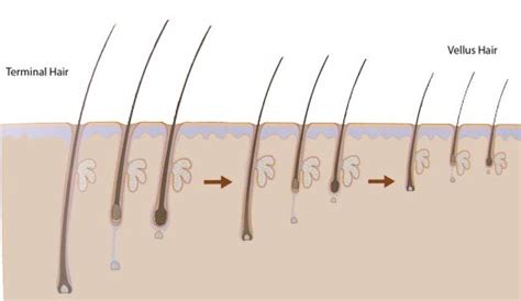 What Is Scalp Micropigmentation?