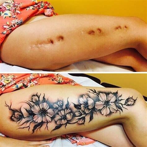 Tatuagens para cobrir cicatrizes - 21 ideias para recuperar a autoestima