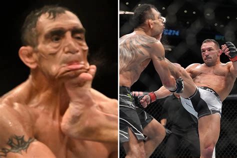 Tony Ferguson left almost unrecognisable with face disfigured from ...