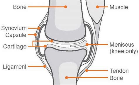 Synovial chondromatosis causes, symptoms, diagnosis, treatment & prognosis