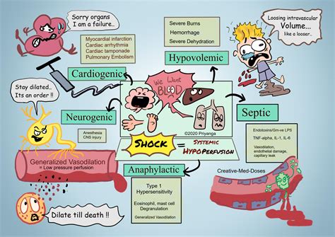 Shock: Systemic hypoperfusion - Creative Med Doses