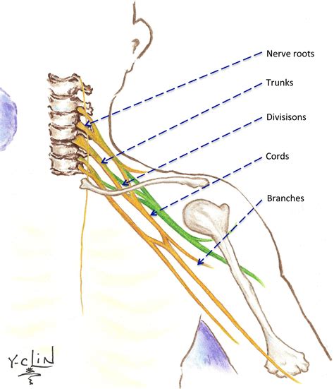 Neonatal / Pediatric Brachial Plexus | Brachial Plexus Program | Michigan Medicine | University ...