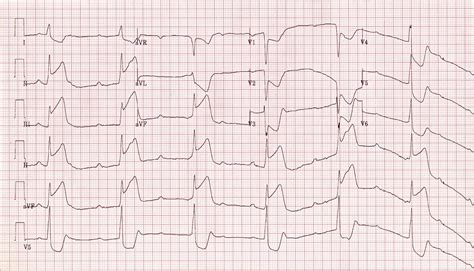 ECGs / EKGs — the simtech