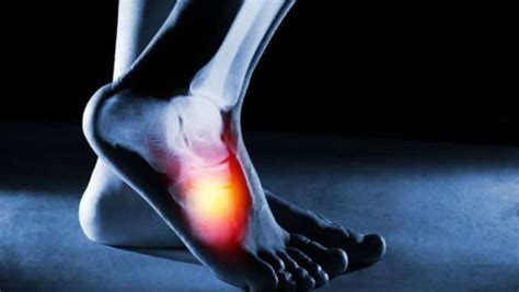 Ankle Surgery Types - Exercises For Injuries