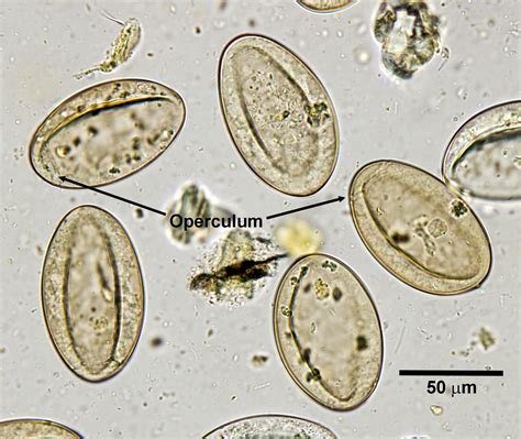 Diphyllobothrium Latum Egg