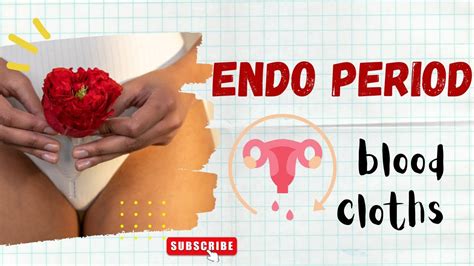 Period blood clots and endometriosis - YouTube