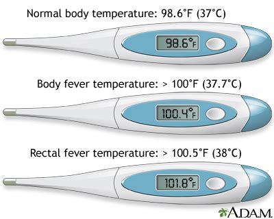 Fever Information | Mount Sinai - New York