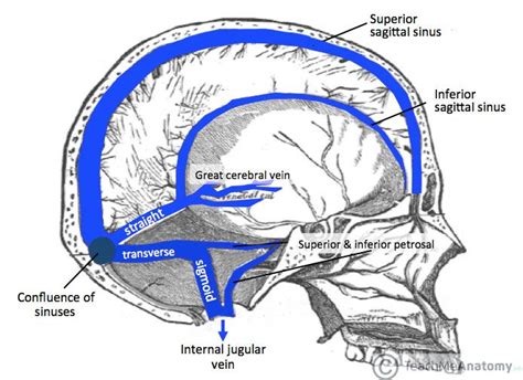 Cerebral Venous Sinus Thrombosis (CVST) | Medical anatomy, Sinus drainage, Paranasal sinuses