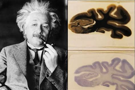 Samples of Albert Einstein's brain on display at the Mütter Museum