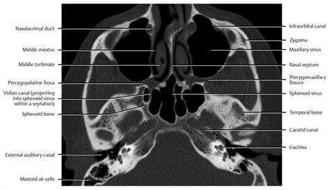 Cross-Sectional Computed Tomography and Magnetic Resonance Imaging ...