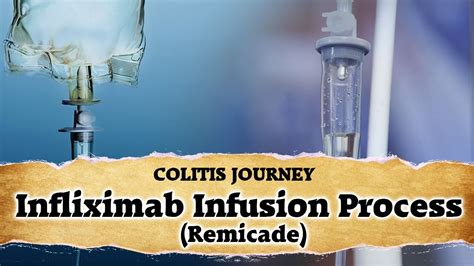 Infliximab Infusion Treatment - Full Process - YouTube