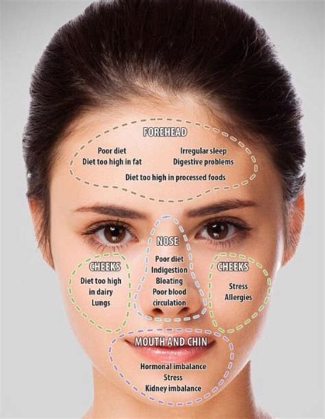 Acne Face Map Causes and Solutions | Acne Face Map Guide