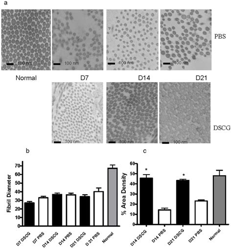 Ultrastructural analysis of collagen fibril content. (a) Transmission... | Download Scientific ...