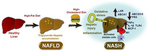 Nutrients | Free Full-Text | Understanding the Impact of Dietary Cholesterol on Chronic ...