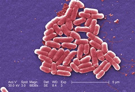 Gram-negative Escherichia coli O157:H7 - DocCheck