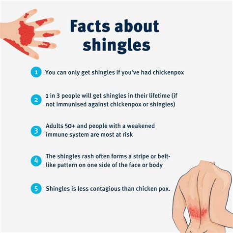 Shingles Catch-up Vaccines are available for adults aged 71 to 79 years until 31 October 2023 ...