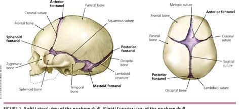 [PDF] The abnormal fontanel. | Semantic Scholar