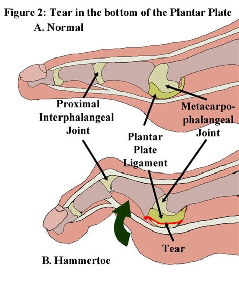 Something terrible is afoot: A look at Russell Okung's sprain and his ...