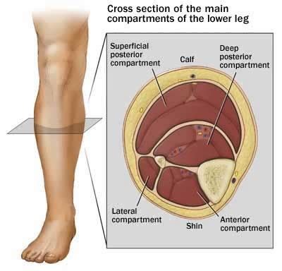 Anterior Compartment Stretch