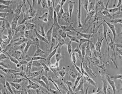 A Simple Approach To Culture Patient-Specific Fibroblasts | Kosheeka