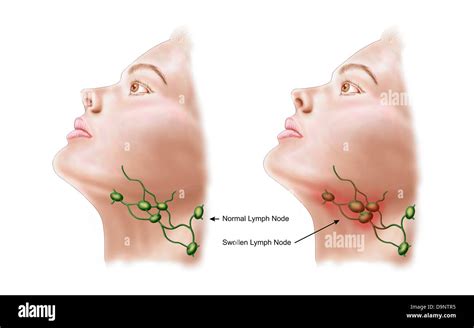 Lymph Nodes Diagram Neck