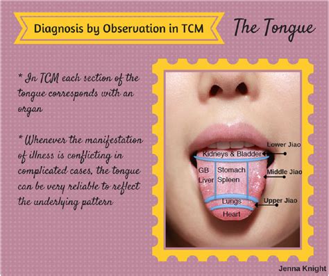 Tcm Tongue Diagnosis Chart