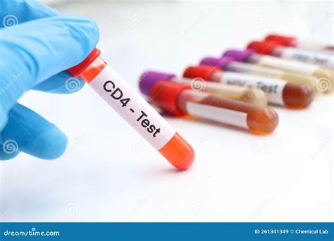 CD4 Test To Look for Abnormalities from Blood Stock Image - Image of ...