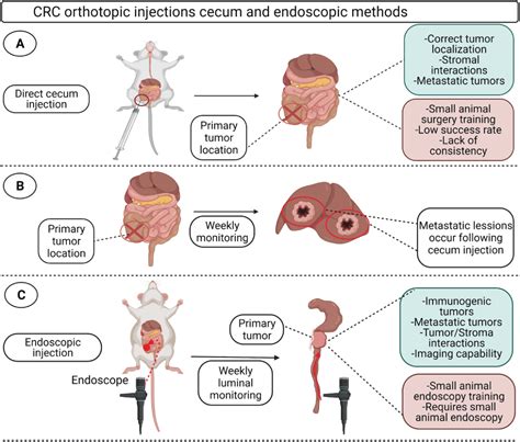 Orthotopic Mouse Models of Colorectal Cancer and Imaging Techniques ...