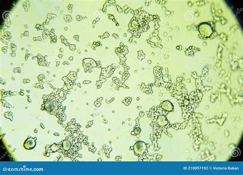 Mold Spores Under The Light Microscope Royalty-Free Stock Photography ...