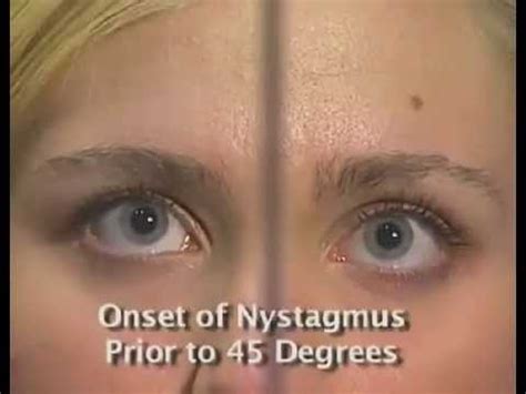 Horizontal Gaze Nystagmus Test - HGN - NHTSA horizontal gaze eye movement test - YouTube