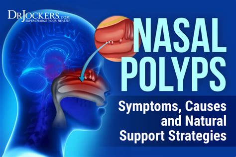 Nasal Polyps