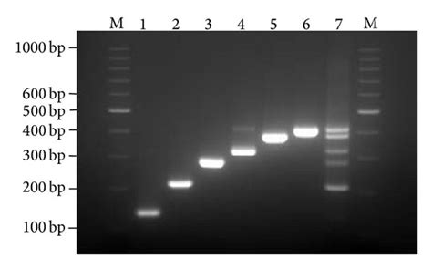 Electrophoresis results of the PCR products on 3% agarose gel. Agarose... | Download Scientific ...