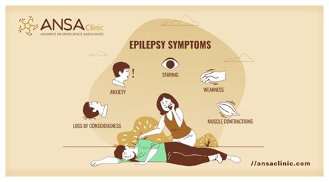 Epilepsy - FergusAshley