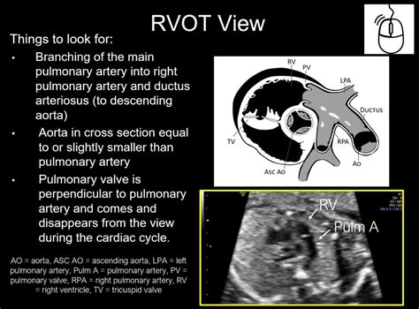 Fetal Cardiac Screening Sonography – Radiology.World