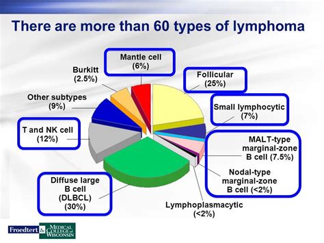 מה הם סוגי B-Cell Lymphoma? - 2024