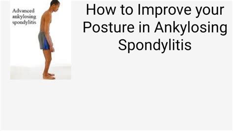 How to improve Posture with Ankylosing Spondylitis - YouTube