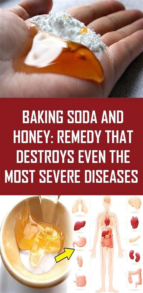 Pin by Emmabazzini on Health | Baking soda and honey, Honey remedies, Herbalism