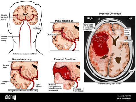 Venticoli immagini e fotografie stock ad alta risoluzione - Alamy