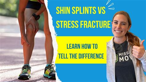 Shin Splints VS. Stress Fracture: Learn How to Tell the Difference - YouTube