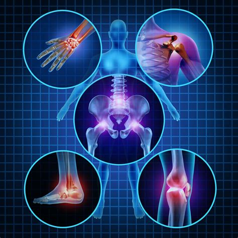 Musculoskeletal Disorders & Long-Term Disability Claims | Kevin McManus Law