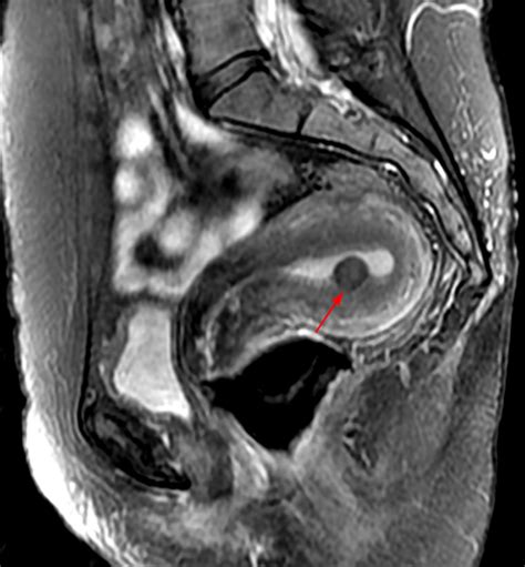 Sumergido Doctrina Alcalde mri female pelvis anatomy Frente Casco Madurar