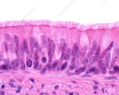 Nonciliated Pseudostratified Columnar Epithelium