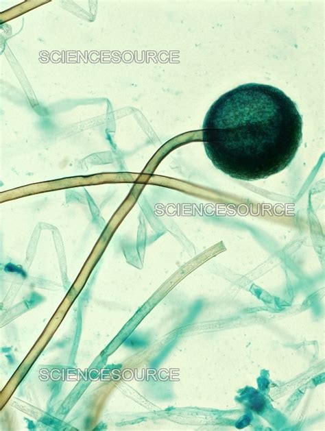 Photograph | Rhizopus sp. Sporangia, LM | Science Source Images