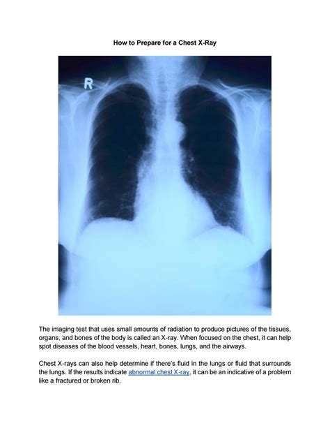 How to Prepare for a Chest X-Ray by chestmed - Issuu