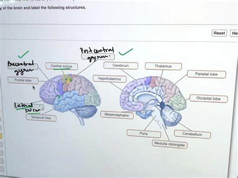 SOLVED: LAB 11 EXERCISE 11-8 Identify the following: Corpus callosum ...