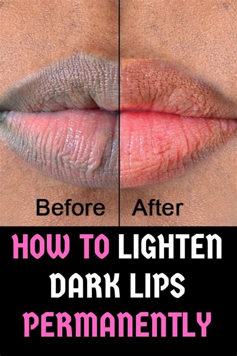 13 home remedies for pink lips naturally in a week at home – Artofit