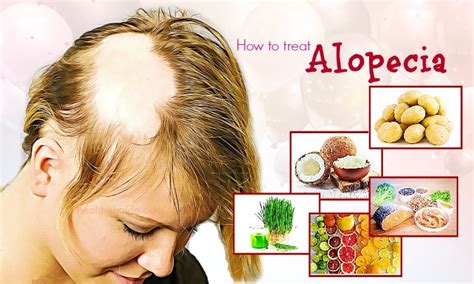 41 Tips How to Treat Alopecia Fast & Naturally in Men and Women