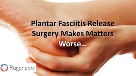 Why Surgery On Plantar Fascia is a Bad Idea - Regenexx Blog