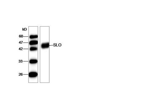 Anti-Streptolysin O Antibody | Mouse Monoclonal ELISA,WB | LSBio