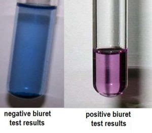 Biuret test-Principle, Requirements, Reagents, Preparation, Procedure ...